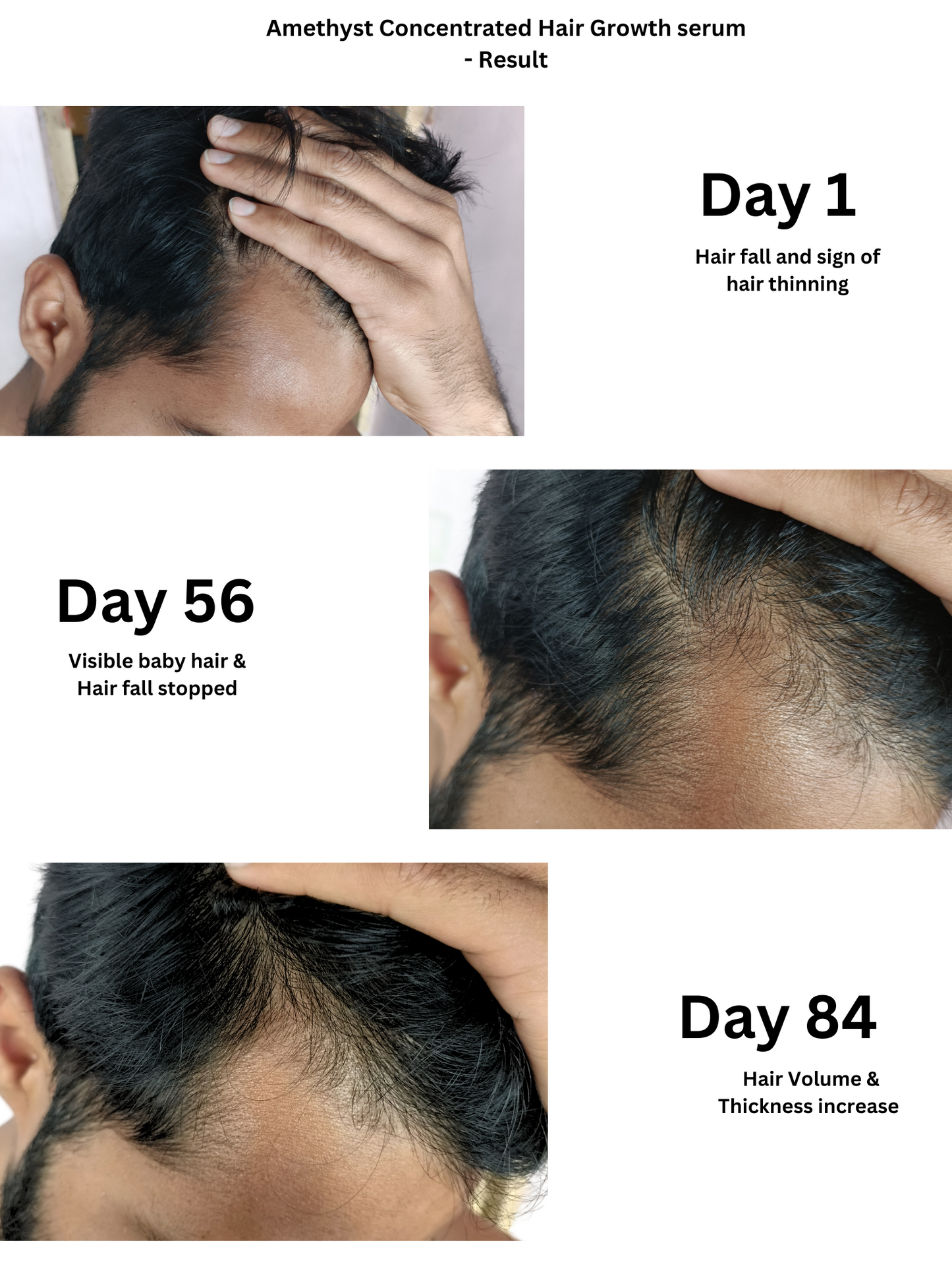 Before and after results of Amethyst Hair Growth Serum showing thicker, denser hair in 8 weeks.
