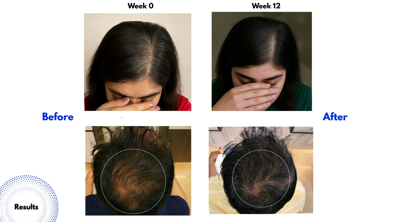 amethyst hair growth serum , india's first hair growth serum , best hair loss solution