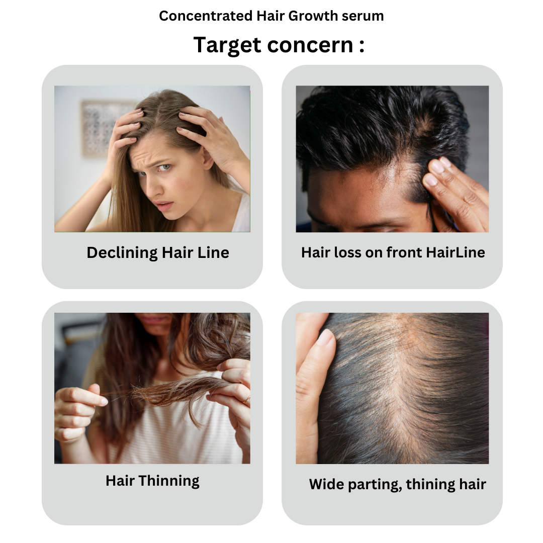 amethyst concentrated Hair growth serum targets Hair loss , Hair thinning , wide parting, declining hair line . hair fall